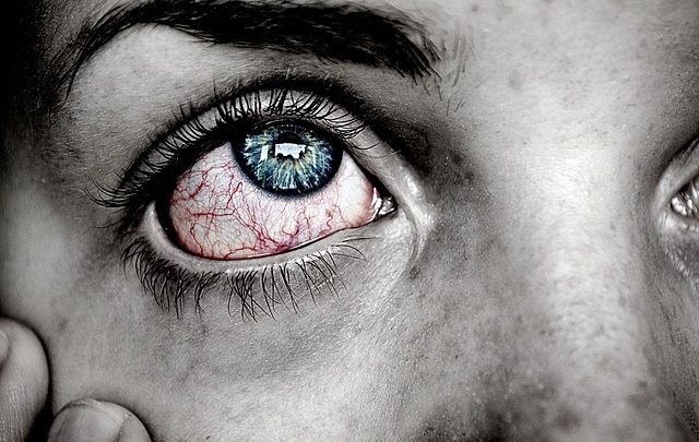 Piekące oczy – jeden z objawów alergii