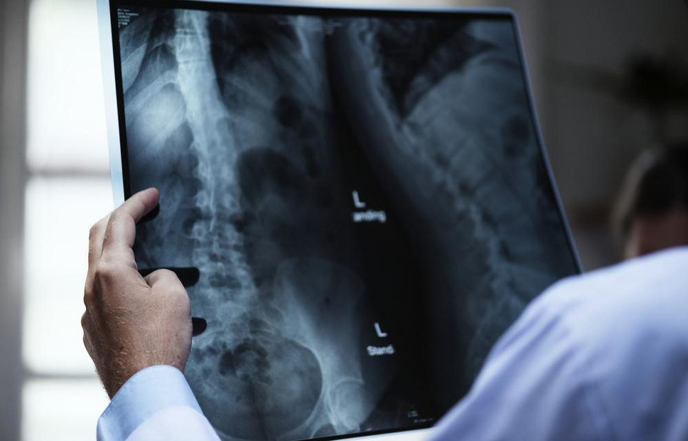 Osteoporoza – charakterystyka